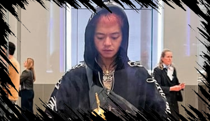 Reza Arap Mengalami Gangguan Depresi Mayor, Apa Dampaknya dan Tindakan Selanjutnya?